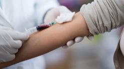Young people’s blood will not make you live forever, FDA warns