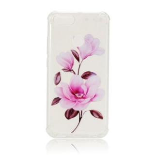 Anti Drop TPU Soft Case for Xiaomi 5X / A1