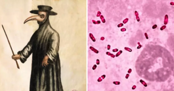A Rare Case Of Plague Was Diagnosed In A Young Boy In Idaho