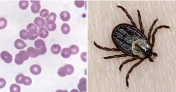 Here Are 8 Diseases You Can Get From Ticks You Probably Didn't Know Existed