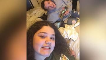 Teenager severely burned imitating TikTok video, family says