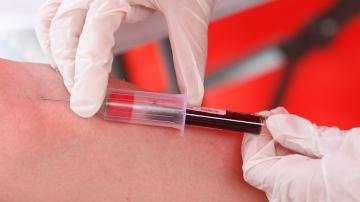 Hungarian capital offers tests amid vaccine efficacy worries