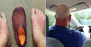 Painfully bad tan lines that will have you reaching for the aloe (38 Photos)