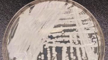 'Superbug' fungus spread in two cities, health officials say