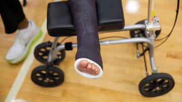 Heal Thyself: Most who tear Achilles tendon can skip surgery