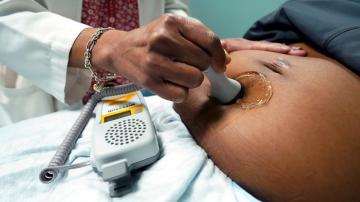 COVID-19 linked to increase in US pregnancy-related deaths