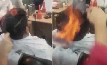Gujarat Man Suffers Severe Burns After "Fire Haircut" Goes Horribly Wrong
