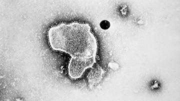 Cases of respiratory virus surge to 2-year-high, CDC data shows