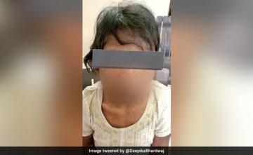 13-Year-Old Help Brutally Thrashed, Tortured By Gurugram Couple, Rescued