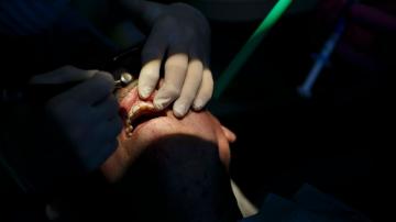 Low-income New Yorkers win the right to a root canal