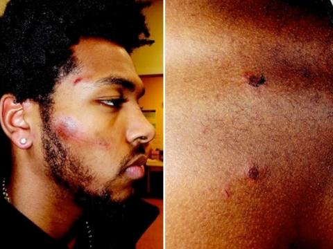 Sterling Brown Photos Show Bloody Face Injuries After NBA Player's Violent Arrest