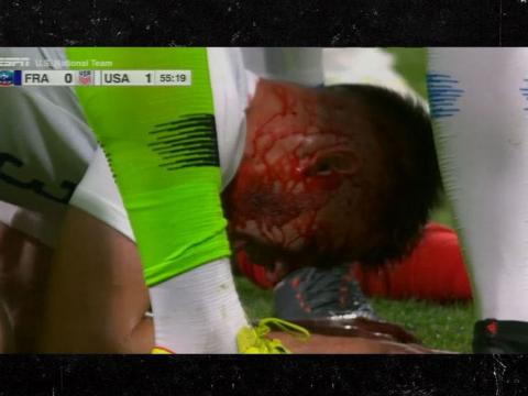 France vs. USA Soccer Features Gnarly, Bloody Headbutt Injuries