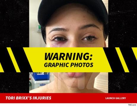 Rich the Kid's GF, Tori Brixx, Suffers Brutal Face Injury from Home Invasion Attack