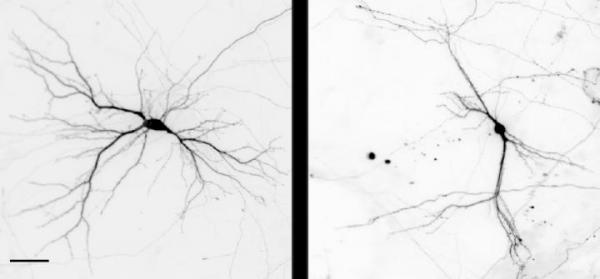 New regulator of neuron formation identified