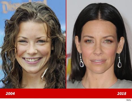 Evangeline Lilly -- Good Genes or Good Docs?