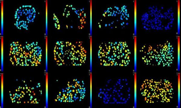 New method reveals how well cancer drugs hit their targets