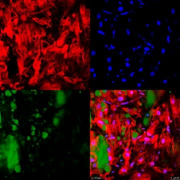 Innovative technique converts white fat to brown fat