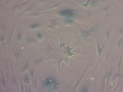 Key aspects of human cell aging reversed by new compounds