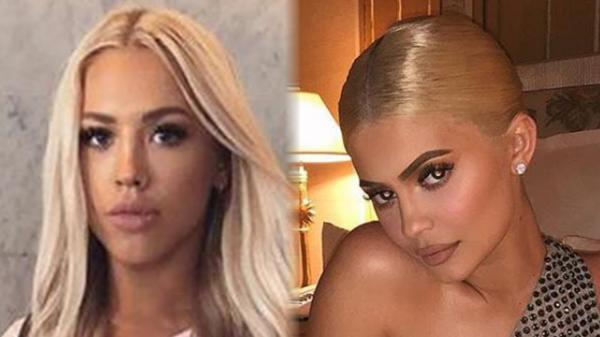 Model COLLAPSES At Kylie Jenners BDay Party & Explains Why She Left in a Stretcher