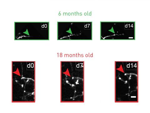 Antidepressant restores youthful flexibility to aging inhibitory neurons in mice