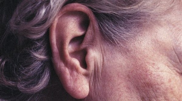 The Dangers of Excessive Earwax