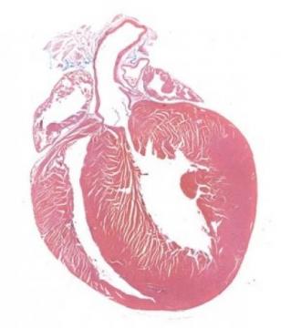 Inhibiting NF-&#954;B improves heart function in a mouse model of Duchenne muscular dystrophy