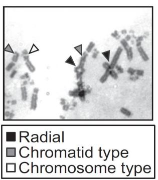 Breakthrough in understanding Warsaw breakage syndrome