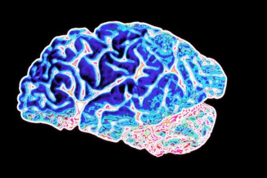 We Need New Biomarkers for Alzheimer's Disease