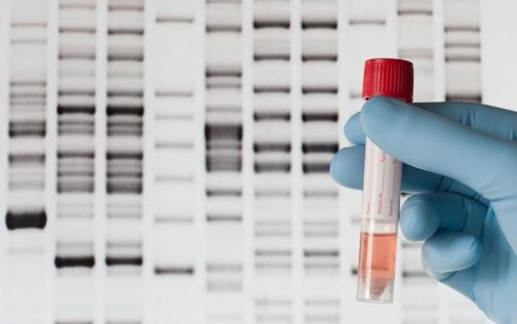 Giant Leap for Gene-Based Testing Estimates Risk of Heart Disease, Breast Cancer and Others