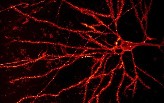 What Makes Human Brain Cells Unique?