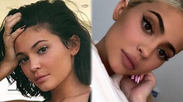 Kylie Jenners Nurse CONFIRMS Lip Fillers But DENIES All Other Procedures