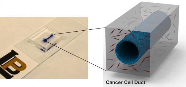 Research on clots could make pancreatic cancer more treatable