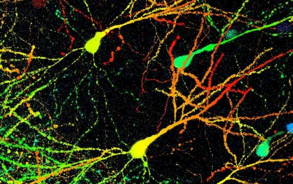 New Atlas Used to ID Brain Parts for Plans and Actions