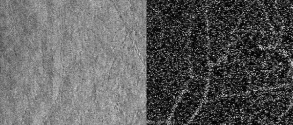 NIH scientists combine technologies to view the retina in unprecedented detail