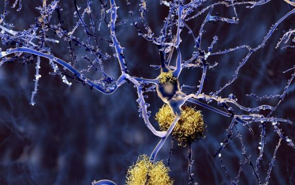 Biogen Halts Studies of Closely Watched Alzheimer's Drug, a Blow to Hopes for New Treatment