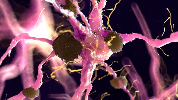 We Need New Ideas for Fighting Alzheimer's