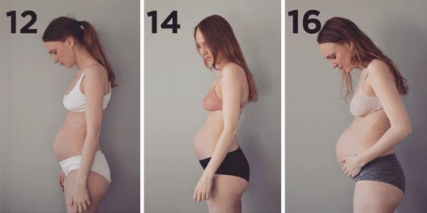 this-is-what-having-triplets-does-to-your-body-16-photos-4.jpg?quality=85&strip=info&w=600