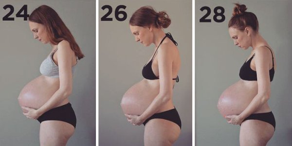 this-is-what-having-triplets-does-to-your-body-16-photos-6.jpg?quality=85&strip=info&w=600