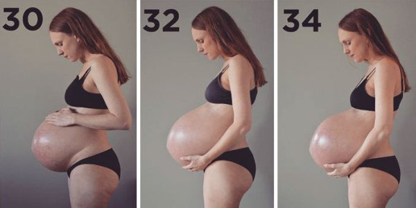 this-is-what-having-triplets-does-to-your-body-16-photos-7.jpg?quality=85&strip=info&w=600