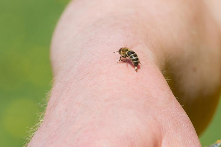 person-getting-stung-by-bee-1024x684.jpg