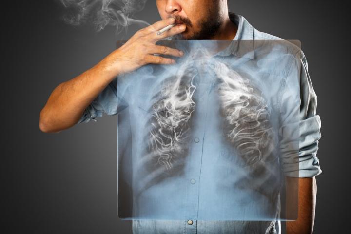 man-with-lung-cancer.jpg?resize=1024%2C683&ssl=1