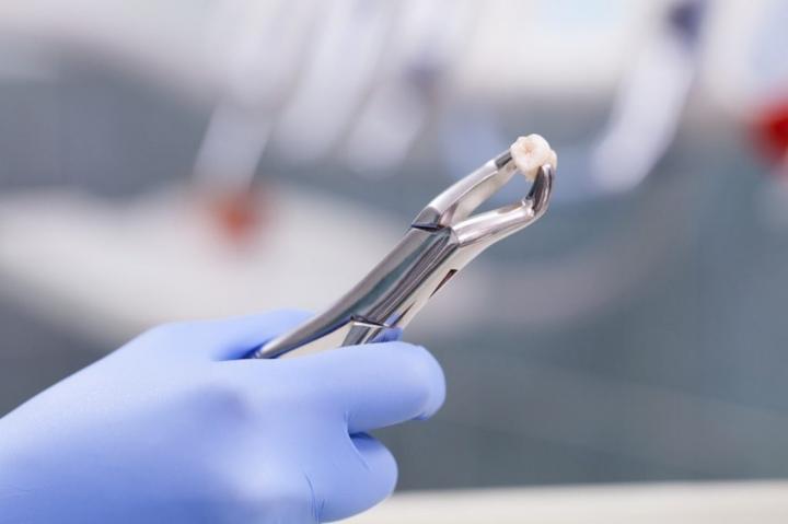 tooth-extraction-1024x682.jpg?resize=1024%2C682&ssl=1