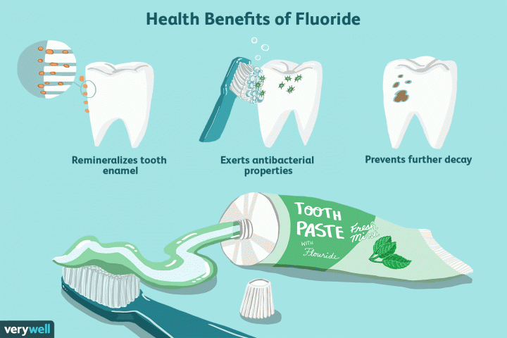 Opt-for-Fluoride-Toothpaste.png