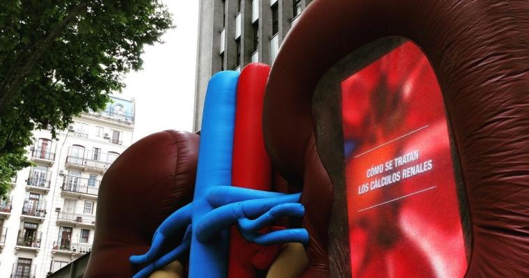 Invitan a recorrer un "riñón gigante" para aprender sobre cálculos renales