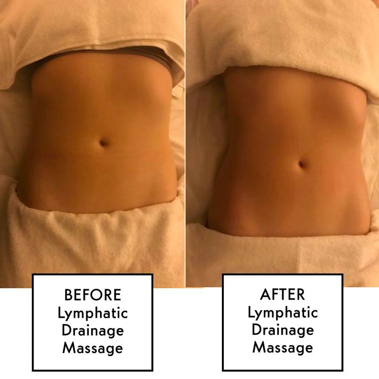 lymphatic-drainage-massage-before-after-1556210584.jpg?crop=1xw:1xh;center,top&resize=480:*