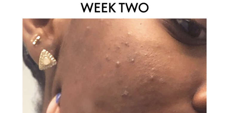 I Tried Skin Fasting For Two Weeks and I’ll Probably Never Do It Again