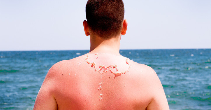 Here's Why You Absolutely Do Not Need To Get A "Base Tan" Before Summer