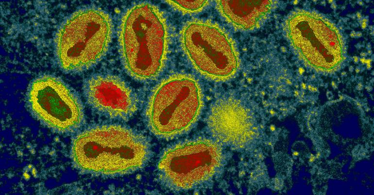 Drug to Treat Smallpox Approved by F.D.A., a Move Against Bioterrorism