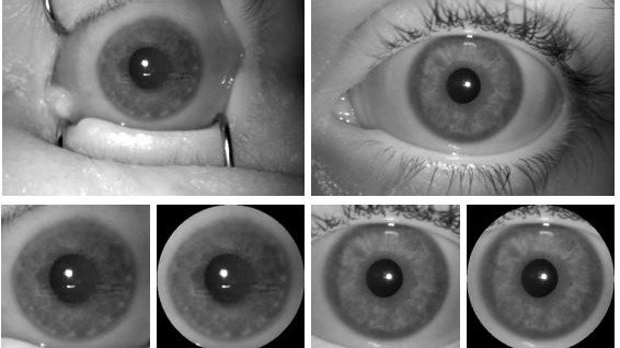Iris scanner can distinguish dead eyeballs from living ones