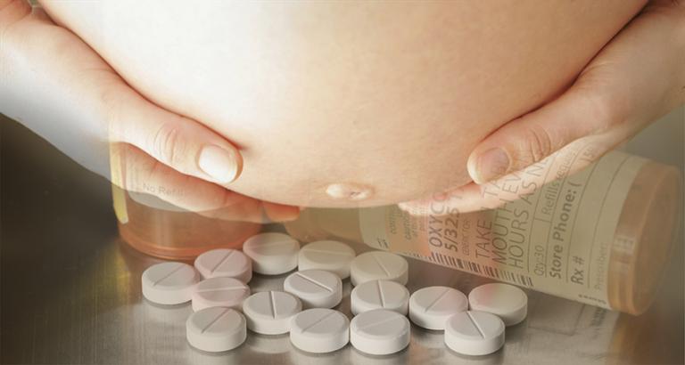 Pregnant women’s use of opioids is on the rise